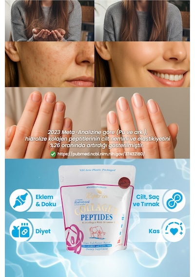 Kiperin %100 Saf Ve Doğal Yüksek Biyoaktif Çift Hidrolize Kolajen Peptitler İçeren Diyet Takviyesi 300gr