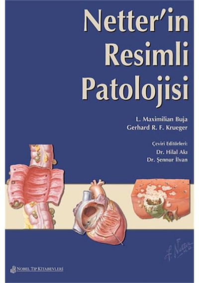 Netter'İn Resimli Patolojisi- Nobel Tıp Kitabevleri
