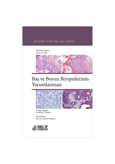 Baş ve Boyun Biyopsilerinin Yorumlanması - Edward B. Stelow - Nobel Tıp Kitabevleri