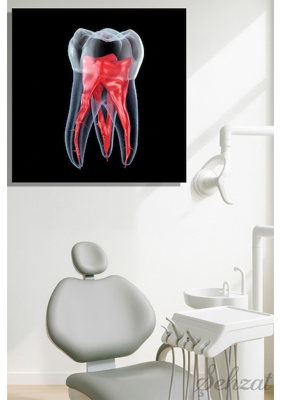 Kare Kanvas Duvar Tablosu Tekli Ağız Diş Sağlığı Dişçi Dental Kök Anatomisi Endodonti Çok Renkli