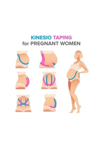 Medwelt Renkli  Bantları Kinezyo Bandı 5cmx5m