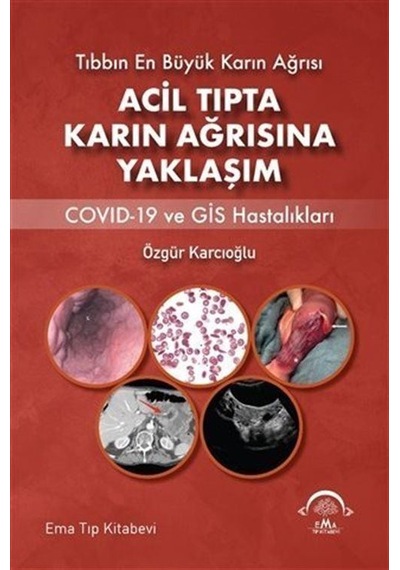 Acil Tıpta Karın Ağrısına Yaklaşım - Covid-19 ve GİS Hastalıkları - Özgür Karcıoğlu - Ema Tıp Kitabevi