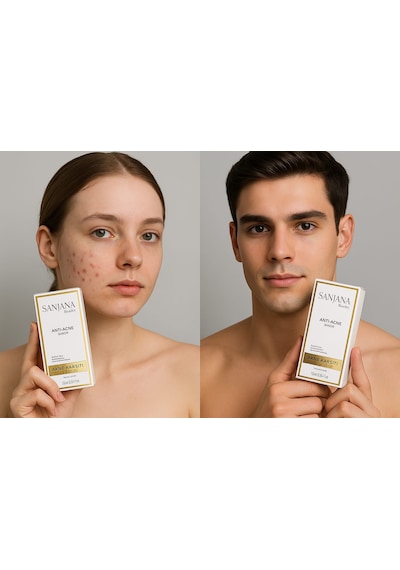 Sanjana Beauty Acne Serum 10 ML