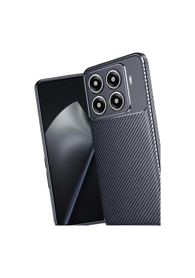 Newface Xiaomi Mi 15t Pro Auto Focus Karbon Kapak - Lacivert
