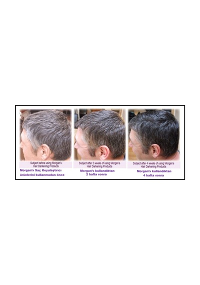 Morgan's Hair Darkening Saç Koyulaştırıcı Bakım Kremi 150 Ml