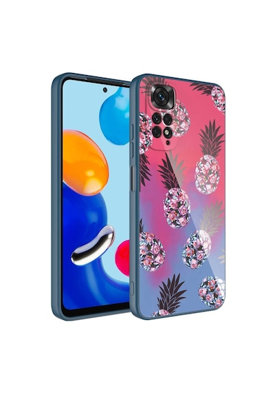 Xiaomi Redmi Note 11S Global Kılıf Epoksi Kamera Korumalı Kılıf
