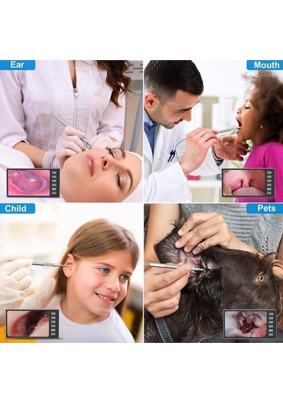 Hiacinto Kulak Kiri Temizleme Aleti, 7 Inc Ips Ekran 3.9mm Hd Kameralı
