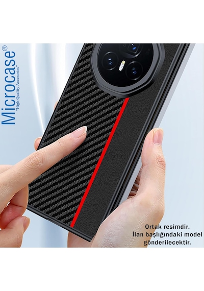 Microcase Xiaomi 17 Ultra Şeritli Lüx Tasarım Kılıf-al5123 Siyah