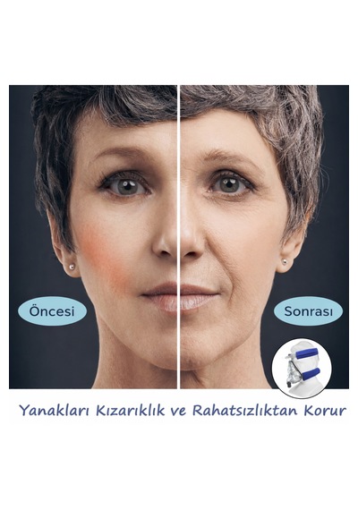 Cpap Kayış Kılıfı 4 Lü Set Yumuşak Polar Maske Kayış Pedi Tam Maske Uyumlu