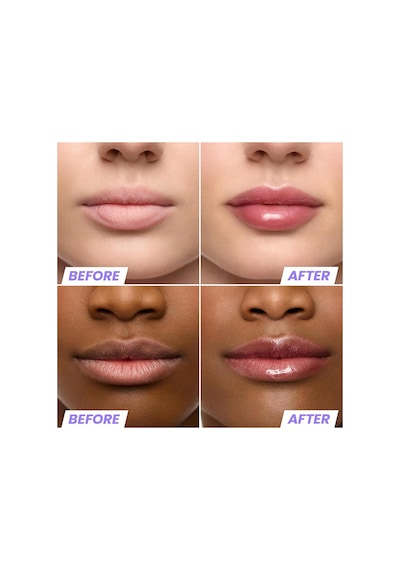 Wonderskin Lip Rehab Nemlendirici Ve Onarıcı Renkli Dudak Serumu Yağı Honey 3.57ml