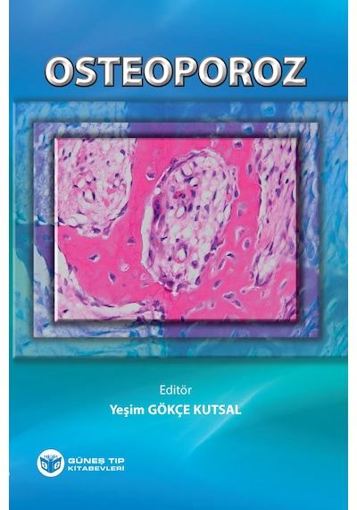 Osteoporoz