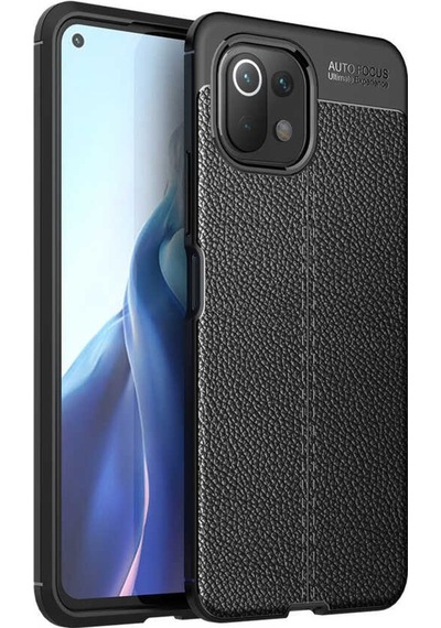 Xiaomi Mi 11 Lite Kılıf Deri Tarzı Niss Silikon Case