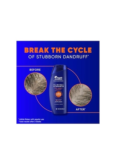 Head & Shoulders Clinical Strength Şampuan 400 Ml