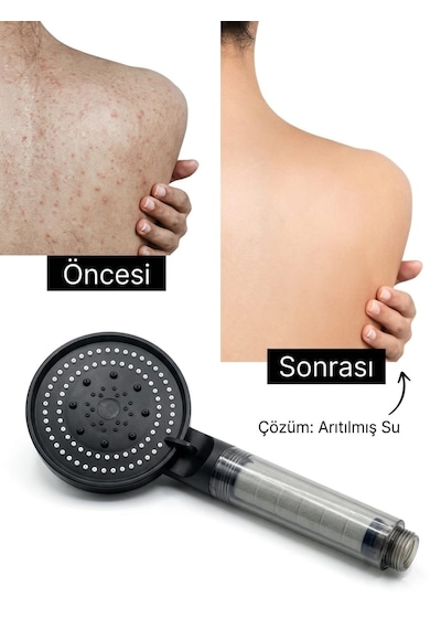 5 Fonksiyonlu Filtreli Duş Başlığı 2 Yedek Filtre Su Arıtmalı, Klor Ve Kireç Önleyici, Yüksek Basınçlı siyah