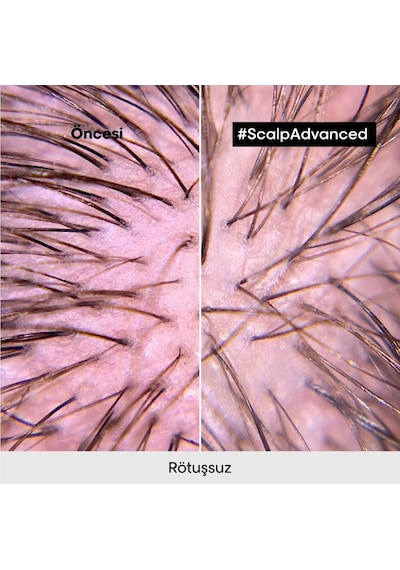 L'Oréal Professionnel Serie Expert Scalp Advanced Hassas Saç Derisi Için Profesyonel Şampuan 500 ML