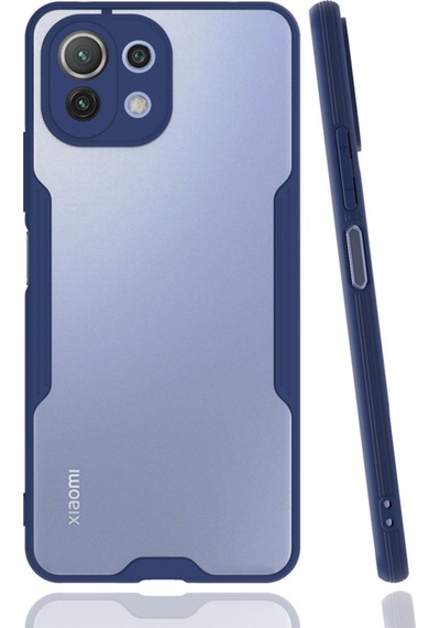 Mi 11 Lite Kılıf Platin Silikon - Lacivert Bzsxx00 1