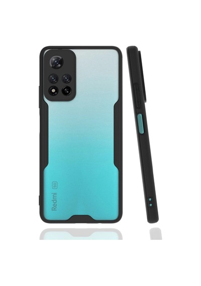 Newface - 987 - Xiaomi Redmi Note 11 Pro Plus 5g Kılıf Platin Silikon - Csmo-tex - - Siyah