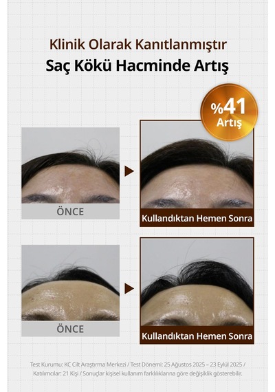 Saç Dökülmesi Karşıtı Ferahlatan Köklere Hacim Sunan Tonik Kundal Beer Yeast Extra Root Volume Tonic