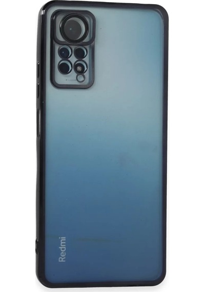 Newface Xiaomi Redmi Note 11 Pro Kılıf Razer Lensli Silikon - Siyah