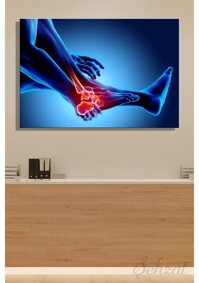 Yatay Tekli Kanvas Duvar Tablosu Modern Klinik Hastane Doktor Röntgen Film Ayak Bilek Ağrı 3d İş