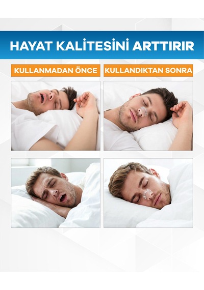 Eldi Manyetik Burun Açıcı Şeffaf Başlangıç Seti 30 Çift Yapışkan Bant-30 Günlük -horlamayı Azaltır-nefesi Rahatlatır