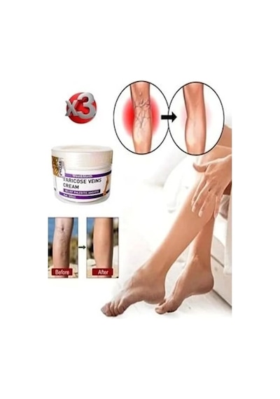 V.ricose And Spider Vns Sthing Leg Cream Bacak Bakım Kremi 100 Ml X 3 Adet