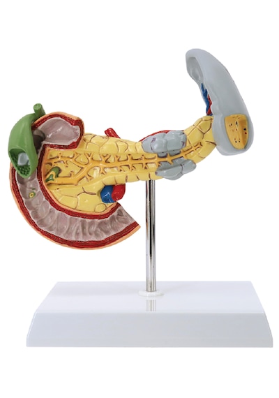 Pankreas, Dalak Ve Duodenum Patoloji Modeli, Gerçek Boyut - Pankreas Kanseri Modeli 01