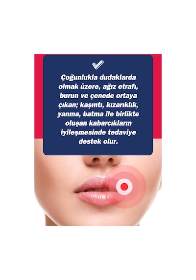 Tto Ux Dudak Kremi 10 ML