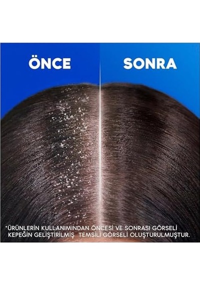 & Shoulders Klasik Bakım Kepeğe Karşı Etkili Şampuan 800ml