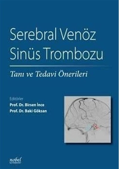 Serebral Venöz Sinüs Trombozu: Tanı Ve Tedavi Önerileri / Nobe...