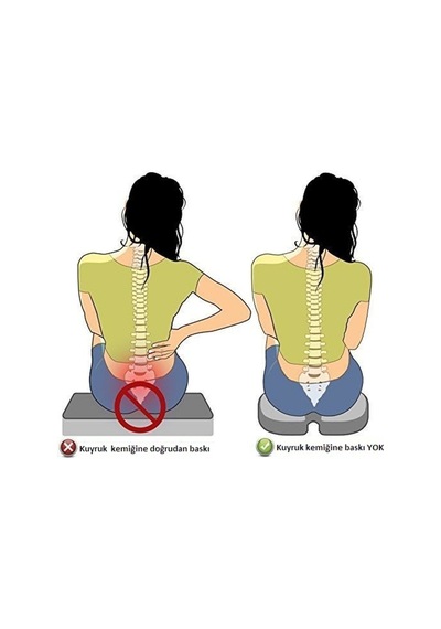 Ht Sağlık Coccyx Kuyruk Sokumu Koksiks Minderi Koltuk Minderi Ortopedik U Koltuk Ev Ofis Oto Oturma