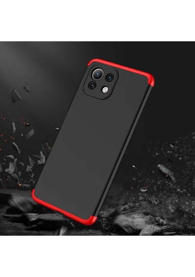 Xiaomi Mi 11 Lite Kilif Zore Kamera Korumali 360 Tam Koruma Ays 496999698