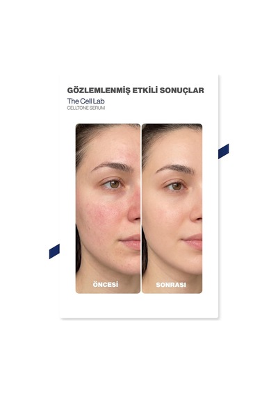 Bariyer Onarıcı & Nemlendirici Yüz Serumu, Pdrn, 50ml