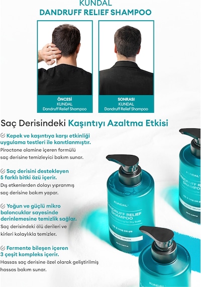 Kepek Karşıtı Bakım Şampuanı %68.5 Daha Az Kepek Kundal Dandruff Shampoo 500ml Apple Green Tea