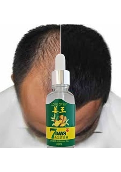 7days 30ml Gingergerminalessentialoil Hair Growth Loss Treatment Serum Unisex Saç Bakım Yağı