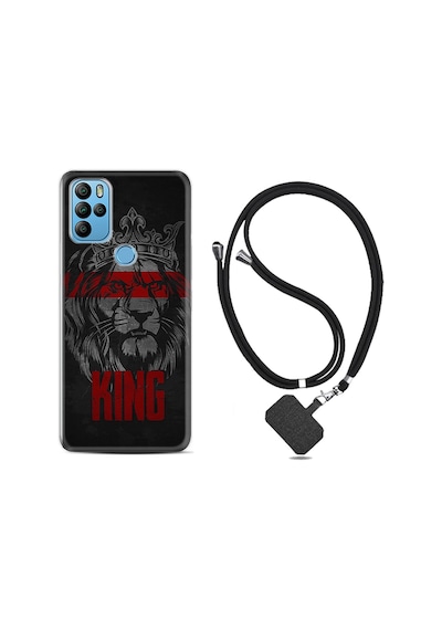 General Mobile Gm21 Pro Kılıf Boyun Askılı King 1894