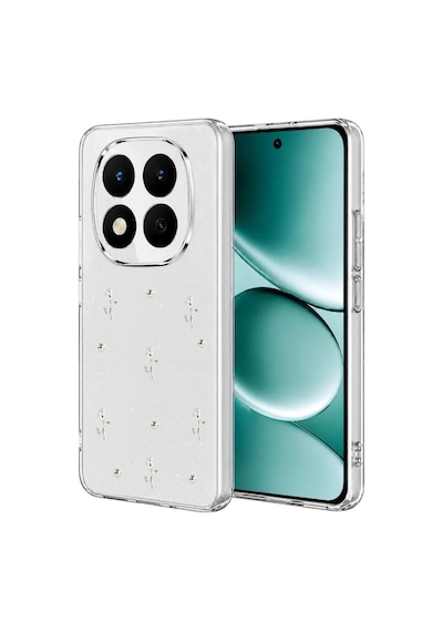 Mey İthalat Redmi Note 15 Pro 4g Fiyonk Desenli Kapak - Desen 4