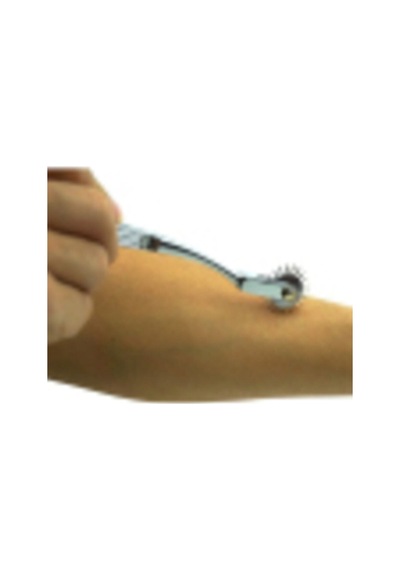 Wartenberg Pinwheel