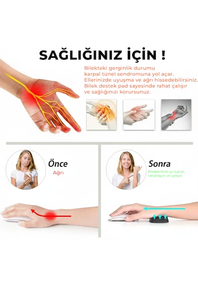 Microcase Ortopedik Mouse Bilek Destek - Kaydırmaz Taban Ergonomik Mouse Önü Bilek Destek Pedi - Al5373 Siyah