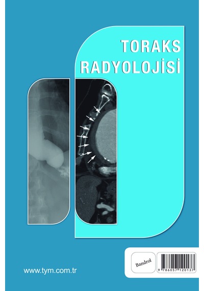Toraks Radyolojisi