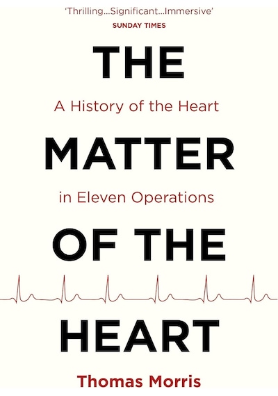 The Matter Of The Heart: A History Of The Heart İn Eleven Operations