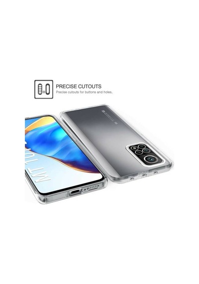 Xiaomi Mi 10T 360 Derece Çift Tarafli Seffaf Kilif 487241801