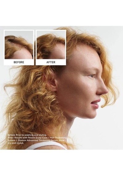 Nioxin System Kit 1