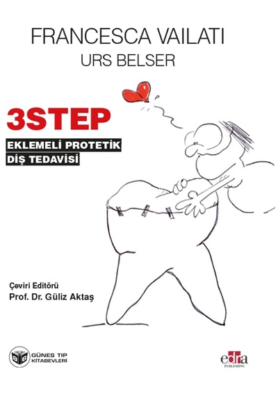 3 Step Eklemeli Protetik Diş Tedavisi Qr Kodlu Videolu 97 Adet Video