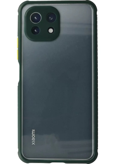 Newface Xiaomi Mi 11 Lite Kılıf Miami Şeffaf Silikon - Koyu Yeşil