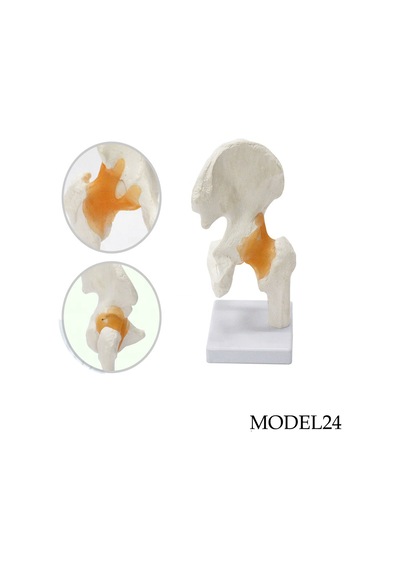 Kalça Eklemi Maketi Model 24