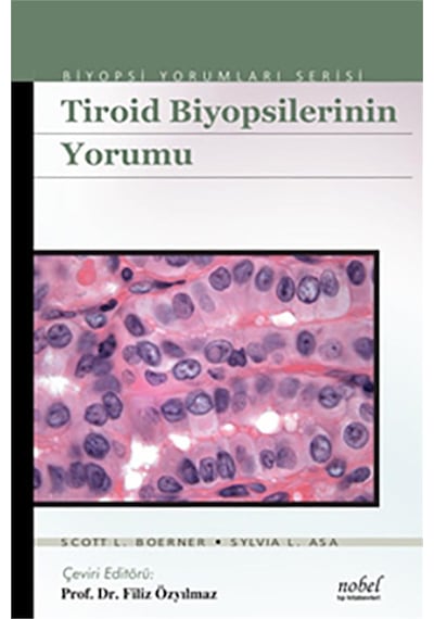 Tiroid Biyopsilerinin Yorumu - Biyopsi Yorumları Serisi N11.509