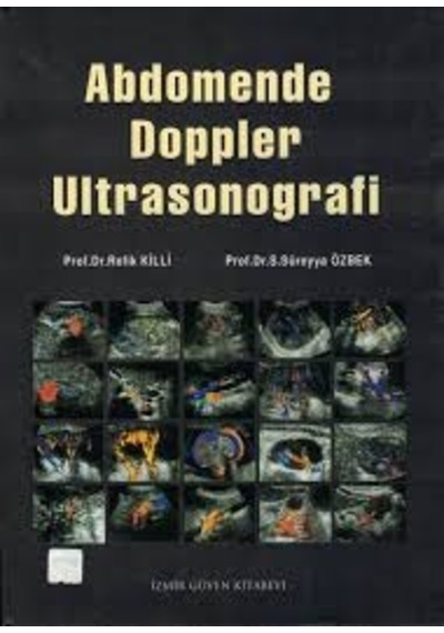 Abdomende Doppler Ultrasonografi