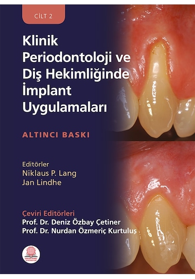 Klinik Periodontoloji Ve Diş Hekimliğinde İmplant Uygulamaları