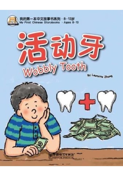 Wobbly Tooth Mfcs